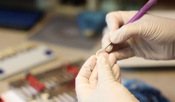 Gloved Hands Fine-Tuning a Dental Crown