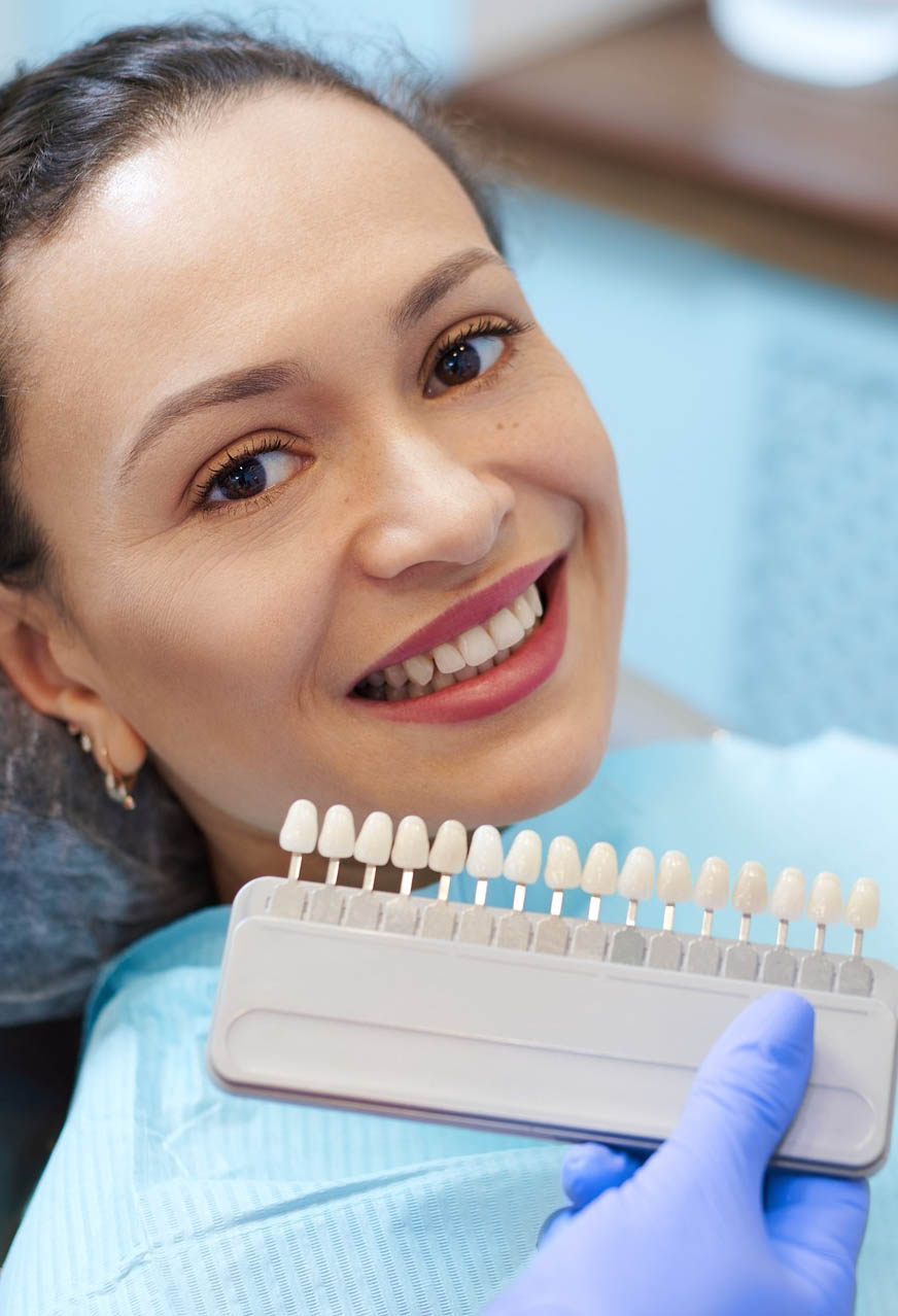 dental bonding shades selection