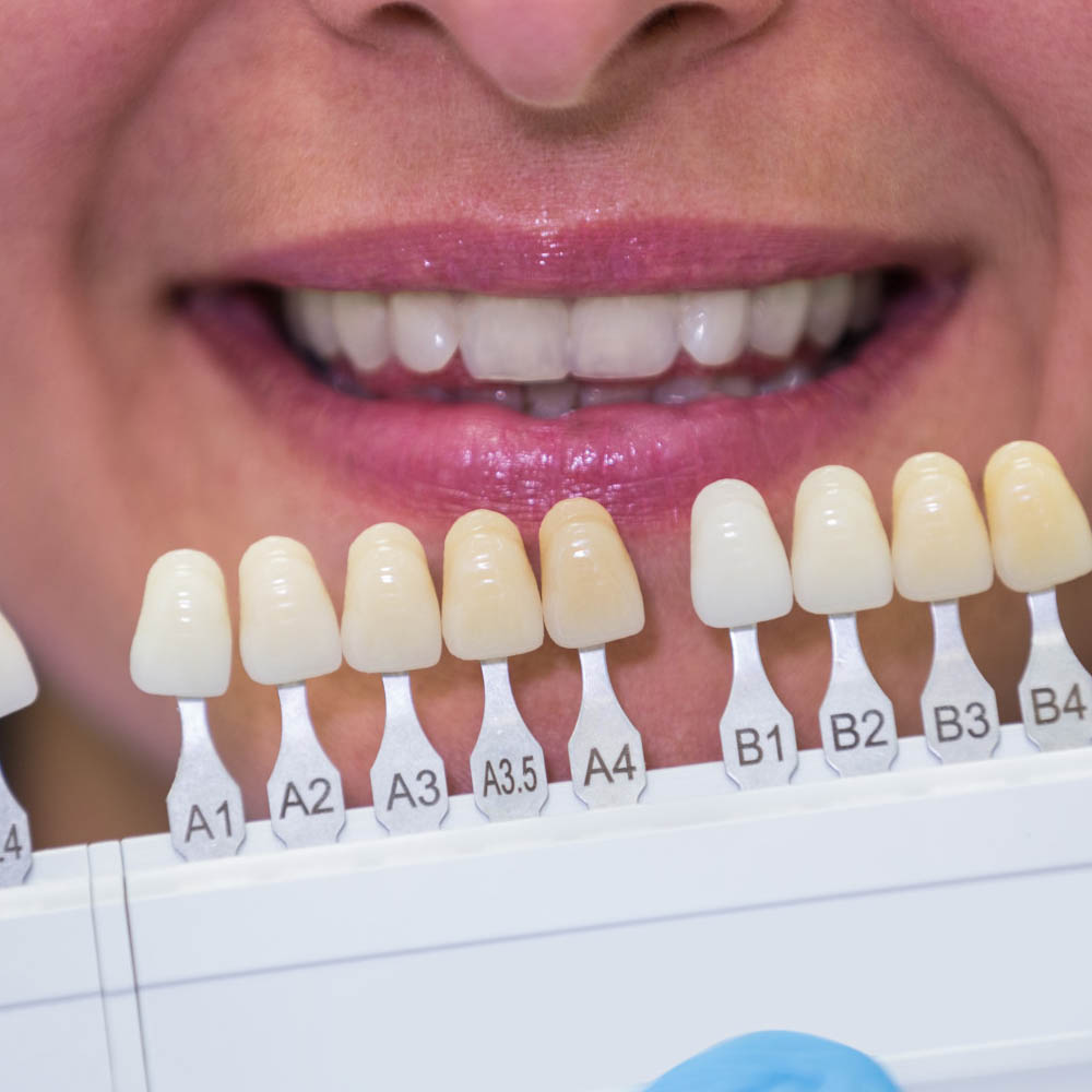 teeth discoloration help